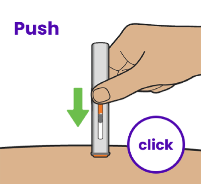 Prep step icon