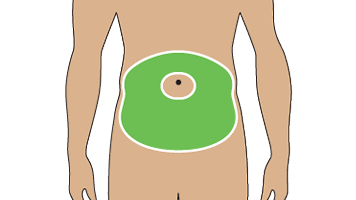 Illustration of Where To Inject The TRYNGOLZA Autoinjector: Abdomen Illustration of Where To Inject The TRYNGOLZA Autoinjector: Abdomen