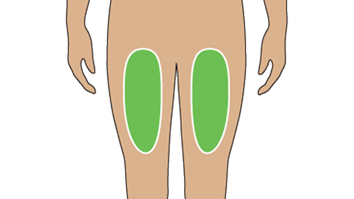 Illustration of Where To Inject The TRYNGOLZA Autoinjector: Front of the Thigh Illustration of Where To Inject The TRYNGOLZA Autoinjector: Front of the Thigh