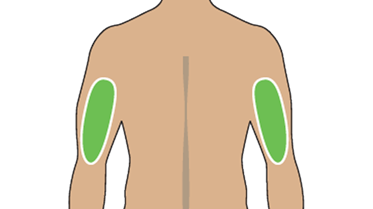 Illustration of Where To Inject The TRYNGOLZA Autoinjector: Back of the Upper Arm Illustration of Where To Inject The TRYNGOLZA Autoinjector: Back of the Upper Arm