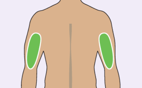 Illustration of Where To Inject The TRYNGOLZA Autoinjector: Back of the Upper Arm